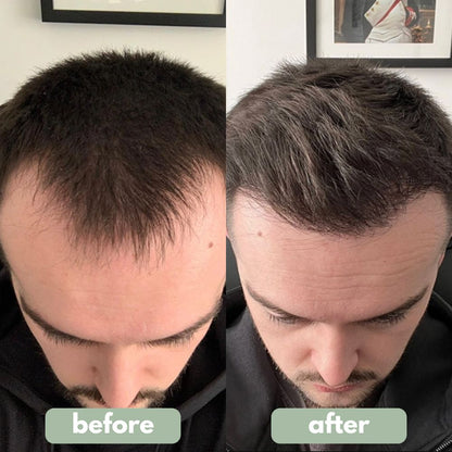 Concluvont- Hair Growth Serum