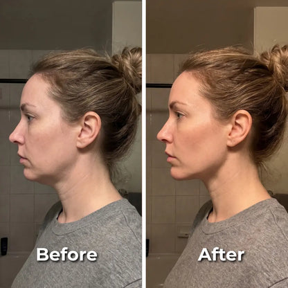 Concluvont Lymphatic Face Brush