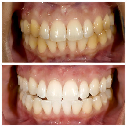 Niacinamide Whitening Toothpaste - TriBright