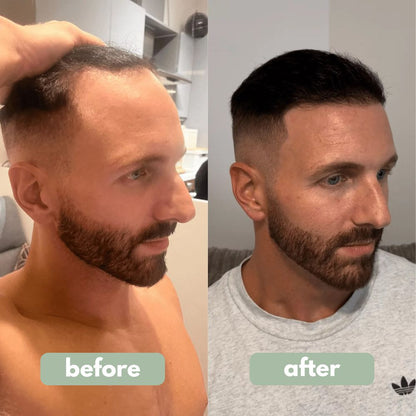Concluvont- Hair Growth Serum